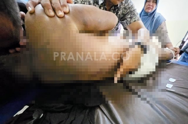 Kuasa Hukum Beberkan Dugaan Intimidasi Keluarga Napi yang Meninggal di Lapas Bontang