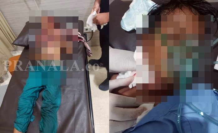 Diterkam Buaya saat Bermain, Bocah 11 Tahun di Bontang Selamat Berkat Heroisme Warga