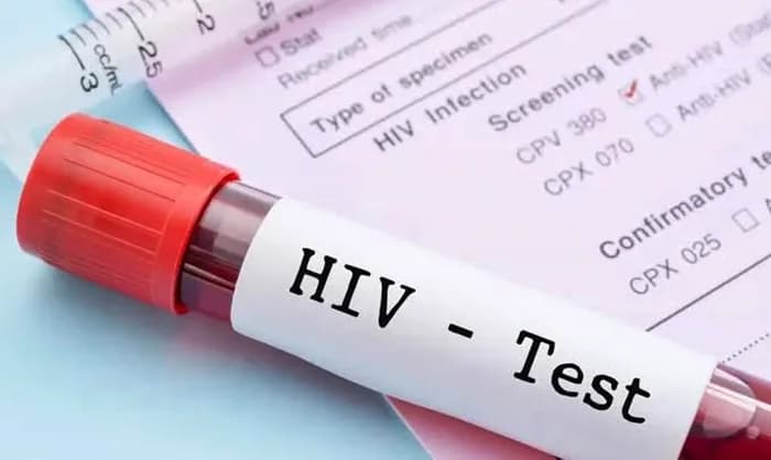 HIV Bontang: 441 Kasus Baru, 253 Masih Berobat