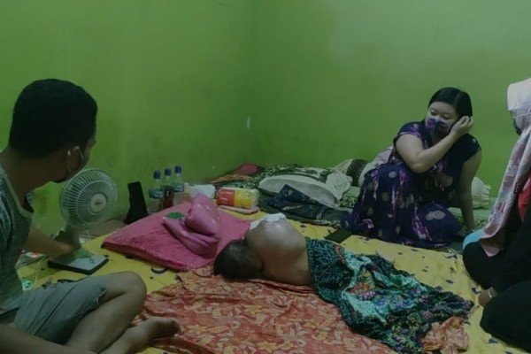 Balita di Tenggarong Berjuang Melawan Tumor Ganas