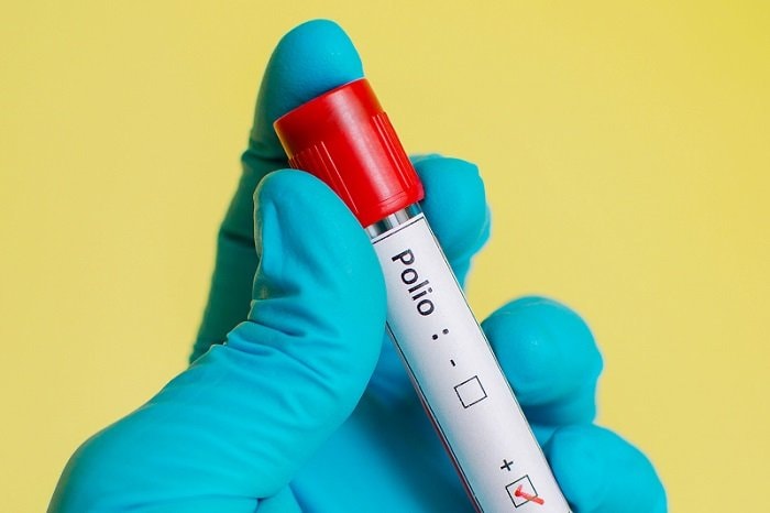 Waspada Suspect Polio di Kaltim, Fasilitas Kesehatan Dipantau 24 Jam