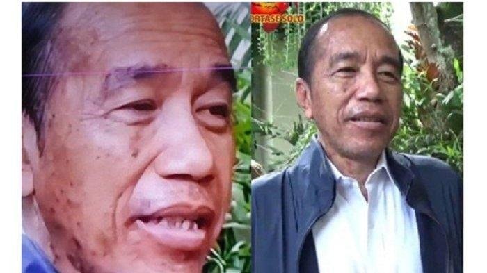 Jokowi Alami Alergi Kulit usai dari Vatikan, Ajudan: Beliau Sangat Sehat