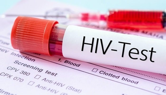 20 Kasus Positif HIV Ditemukan di Bontang