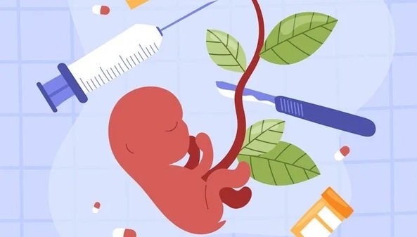 Terdakwa Kasus Aborsi di Bontang Dituntut Tiga Tahun Penjara