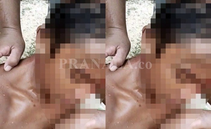 Remaja Diserang Buaya di TPI Tanjung Limau Bontang, Alami Luka di Kepala dan Leher