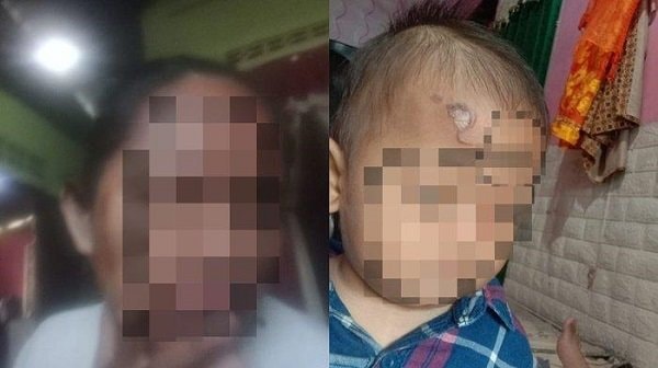 Ibu dan Anak di Balikpapan Disiram Air Panas