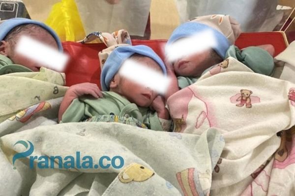 Bayi Kembar Tiga Berhasil Lahir di RSUD Panglima Sebaya Paser