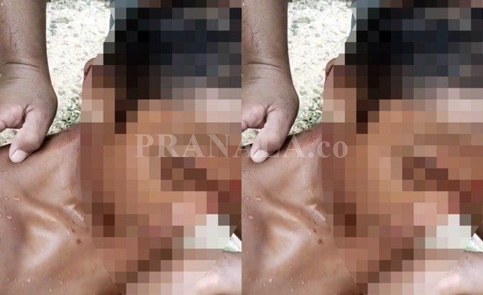 Remaja Diserang Buaya di TPI Tanjung Limau Bontang, Alami Luka di Kepala dan Leher
